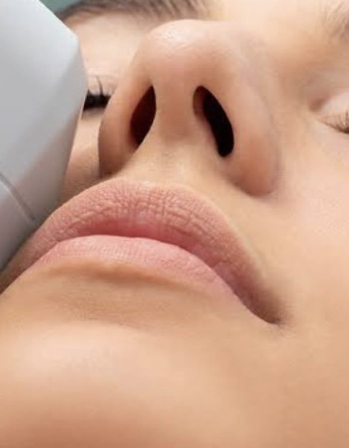Hifu Face and Neck